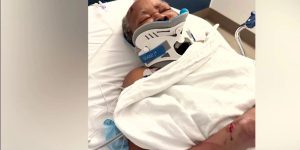 Elderly woman discovered alone and injured; family suspects hit-and-run crash